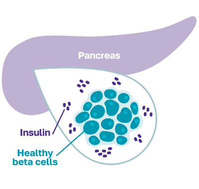 Insulin-producing cells (called beta cells) produce the insulin your body needs to regulate blood sugar.