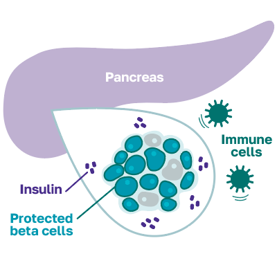 The goal of CNP-103 is to protect your remaining beta cells so they can continue to produce insulin.